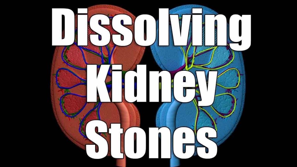 Kidney Stones Extreme Health Academy